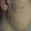 Before Hair Remove
