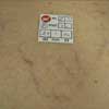 Before Deep Veins Treatment